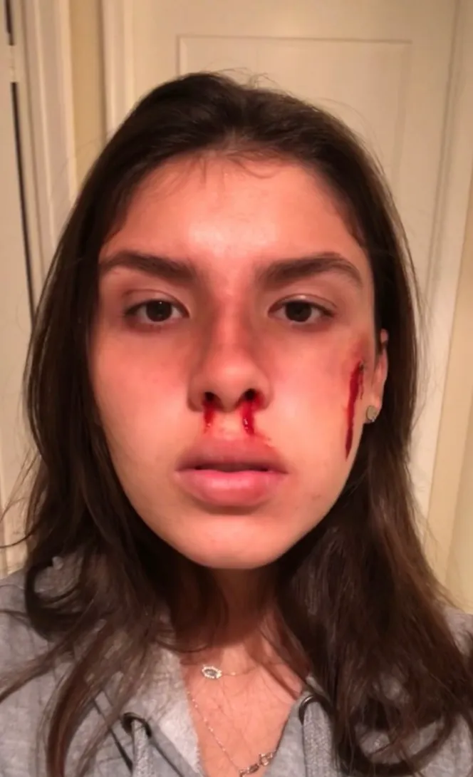 Beat Up